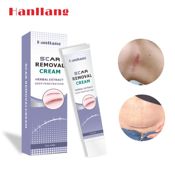 Pregnancy Stretch Mark Cream Manufacturer - Repair Scar Removal Acne Cream