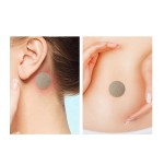 Anti Nausea Patch Manufacturer - Disposable Motion Sickness Relief