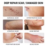 Scar Removal Cream Factory - 2024 New Promote Stratum Corneum Recovery
