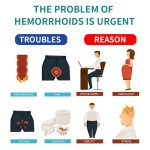 Hemorrhoids Cream Manufacturer - Anal Fissure Pain Relief Ointment