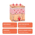 Scar Removal Cream Supplier - Hanliang Effective Stretch Mark Cream