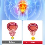 Scar Removal Cream Supplier - Hanliang Effective Stretch Mark Cream