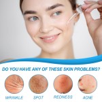 Skin Repair Gel Factory - Moisturizing Scar Tattoo