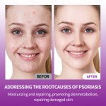 Antipruritic Ointment Manufacturer - OEM ODM External Soothing Dermatitis