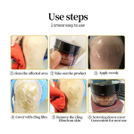 Knee Joint Cream Factory - China Plaster 2023 Hot Products Lumbar