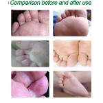 Antipruritic Cream Factory - Chinese Traditional Herbal Skin