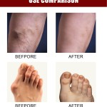 Detox Foot Pads Manufacturer - Hot Sales OEM ODM Wormwood Healthcare