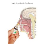 Anti Snore Oil Manufacturer - Chinese Traditional Nose Rhinitis 10ml