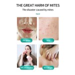 Mites Removal Spray Factory - New Trending Strong Effect Organic