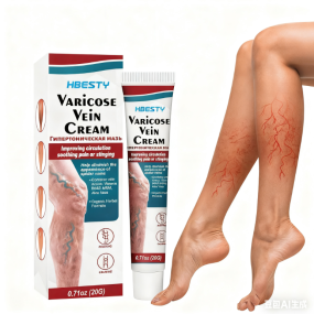 Varicose Veins Cream Manufacturer - Natural Horse Chestnut Leg Discomfort