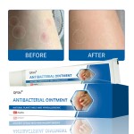 Skin Antibacterial Ointment Manufacturer - Professional Herbal Quick Itching