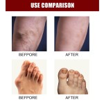 Detox Foot Pads Manufacturer - Hot Sales OEM ODM Wormwood Healthcare