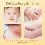 Mosquito Patch Manufacturer - Outdoor OEM Natural Oil Safe Baby