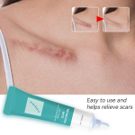 Medical Scar Gel Factory - Private Label All Skin Acne Mark 15g