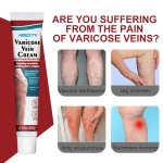 Varicose Veins Cream Manufacturer - Natural Horse Chestnut Leg Discomfort