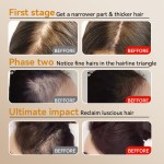 Hair Loss Shampoo Manufacturer - Ginger Nourishing Adult Prevention