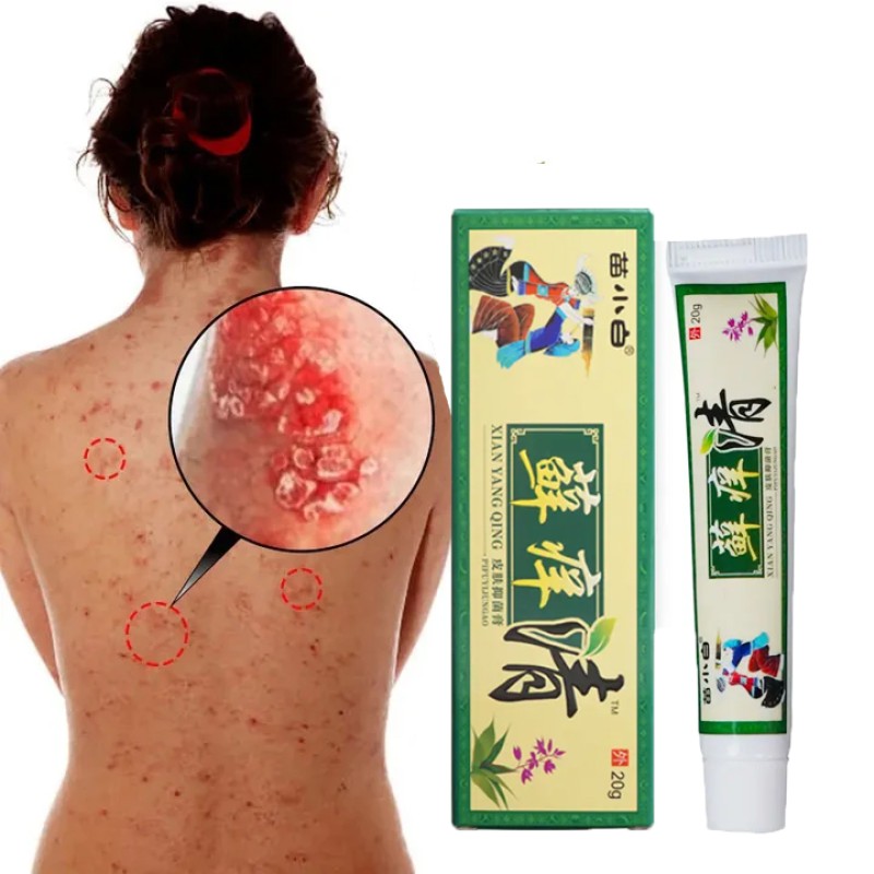 Psoriasis Cream Manufacturer - New Trending Healthcare Supply Moisturizing