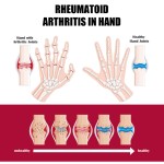 Detox Foot Pads Manufacturer - Hot Sales OEM ODM Wormwood Healthcare