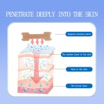 Herbal Nose Patch Supplier - Chinese Allergy Relief Disposable