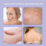 Herbal Mud Supplier - Wholesale Wang Baicao Cream