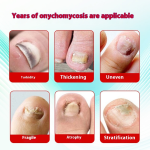 Mosquito Patch Supplier - Japan Plant Oil Children