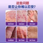 Tinea Plaster Factory - Keratosis Eczema Dandruff Removal