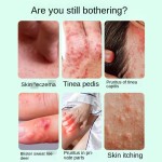 Wet Diagnosis Factory - Piyan Antipruritus Treatment