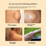 Lump Removal Patch Supplier - Subcutaneous Nodule Soothing Plaster