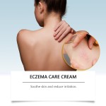 Bee Venom Cream Manufacturer - Eczema Care Hydrating Smoothing