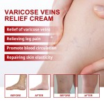 Varicose Veins Cream Supplier - Custom Leg Blood Massage