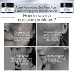 Acne Spot Cream Supplier - New Efficacy Pimple Repair