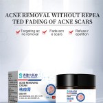 Anti Acne Cream Manufacturer - Strong Effect Acne Removal