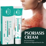 Anti-Itch Cream Factory - OEM ODM Eczema Psoriasis Care