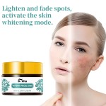 Face Cream Supplier - Factory Price Spot Whitening Freckle