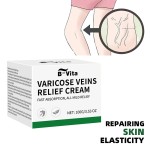Varicose Veins Cream Supplier - Custom Leg Blood Massage