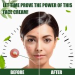 Tea Tree Oil Cream Factory - Organic Acne Pimple Removal