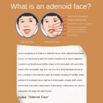 Adenoid Patch Supplier - Herbal Snoring Solution Breathing