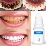 Teeth Whitening Supplier - Professional Yellowing Formula