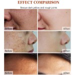 Face Cream Factory - Natural Freckle Dark Spot Repair Cream