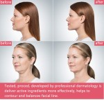 Slimming Face Patch Factory - OEM Double Chin Reducer V Shape