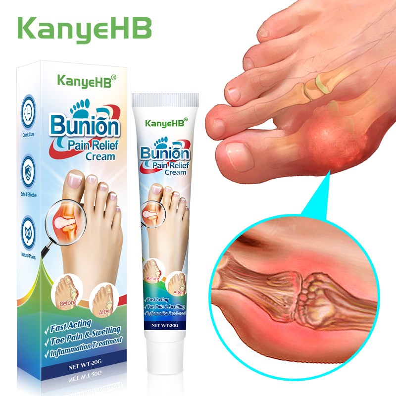 Joint Pain Ointment Manufacturer - Toe Valgus Hand Wrist