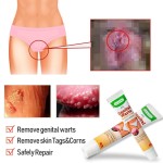 Genital Wart Cream Manufacturer - Papillomas Removal Ointment
