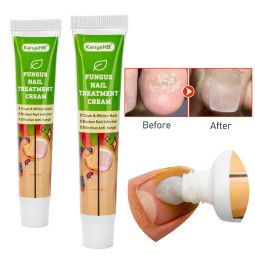 Foot Cream Supplier - Antifungal Infection Repair Gel