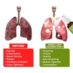 Lung Cleansing Spray Manufacturer - Herbal Breath Detox Mist