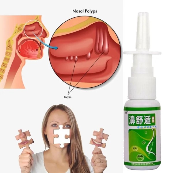Herb Spray Supplier - OEM ODM Nasal Health Care