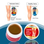 Leg Cramps Cream Factory - Blue Veins Bulging Sore