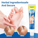 Wart Cream Manufacturer - Cleansing Sterilization External