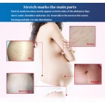 Belly Lines Cream Factory - Pregnancy Orange Peel Marks