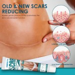 Acne Cream Manufacturer - Surgical Stretch Marks Repair