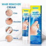 Wart Cream Manufacturer - Cleansing Sterilization External